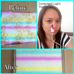 Before and After Blood Viscosity using the Intranasal Light Theraphy