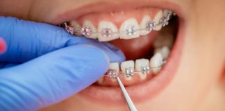 7 Benefits of Cosmetic Dentistry 5 Unexpected Benefits of Braces