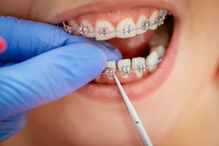 7 Benefits of Cosmetic Dentistry 5 Unexpected Benefits of Braces